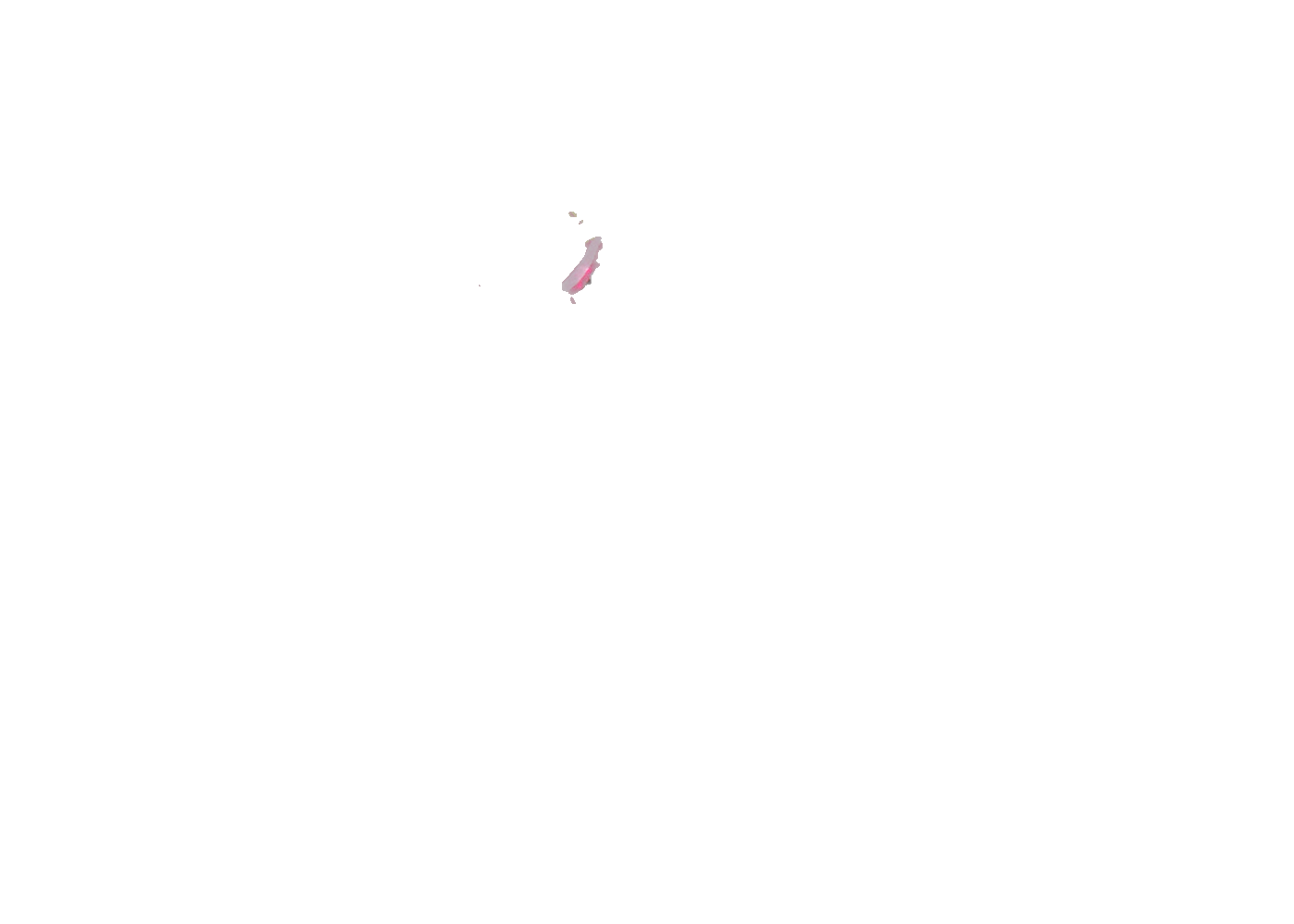 Sp5der P*NK V2 Hoodie Pink, Pink (sp5der-pnk-v2-hoodie-pink)